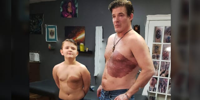 Derek Brew Sr. (right) has a matching tattoo on his chest with his son's (left) birthmark. 