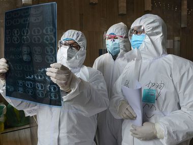 Doctors look at a lung CD image at a hospital in Seoken, China.