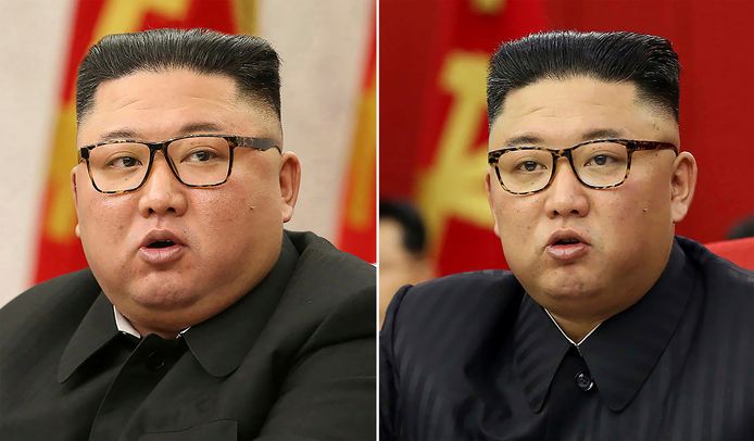 A comparison of a photo taken on February 8 (left) and June 15 (right) shows Kim Jong-un lost weight in his face.